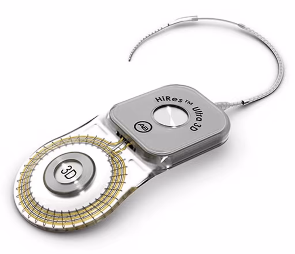 Implante coclear HiRes Ultra 3D de Advanced Bionics