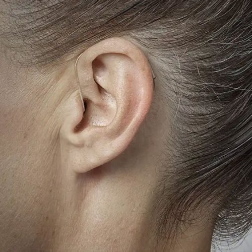 Los audífonos retroauriculares de Clínicas Para Oír Mejor son ideales para personas con pérdida auditiva moderada a severa o con conductos auditivos pequeños. Todos sus componentes se colocan detrás del oído y se conectan mediante un tubo transparente al auricular que va dentro del canal auditivo.