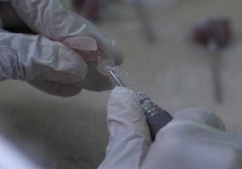 Clínicas Para Oír Mejor: Soluciones de salud auditiva en Guatemala: estudios audiológicos, aparatos auditivos, implantes cocleares y atención especializada